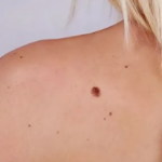 Jak codzienne nawyki wpływają na kondycję skóry i ogólną witalność